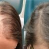 ⁦كورس علاج تساقط الشعر و الانبات⁩ - الصورة ⁦3⁩