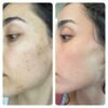 ⁦برنامج نضاره البشره الكامل⁩ - الصورة ⁦4⁩