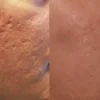 ⁦برنامج علاج تجاعيد الوجه العميقة⁩ - الصورة ⁦2⁩