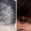 ⁦كورس علاج تساقط الشعر و الانبات⁩ - الصورة ⁦10⁩