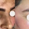 ⁦كريم تفتيح البقع الداكنة⁩ - الصورة ⁦5⁩