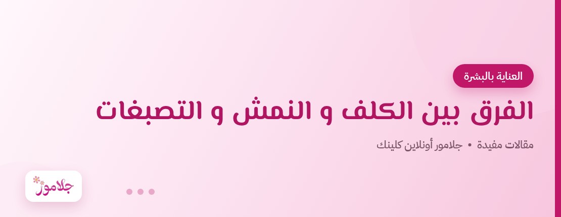 الفرق بين الكلف و النمش و التصبغات