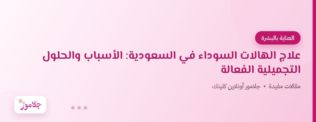علاج الهالات السوداء في السعودية: الأسباب والحلول التجميلية الفعالة