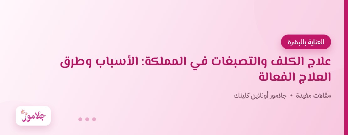 علاج الكلف والتصبغات في المملكة: الأسباب وطرق العلاج الفعالة