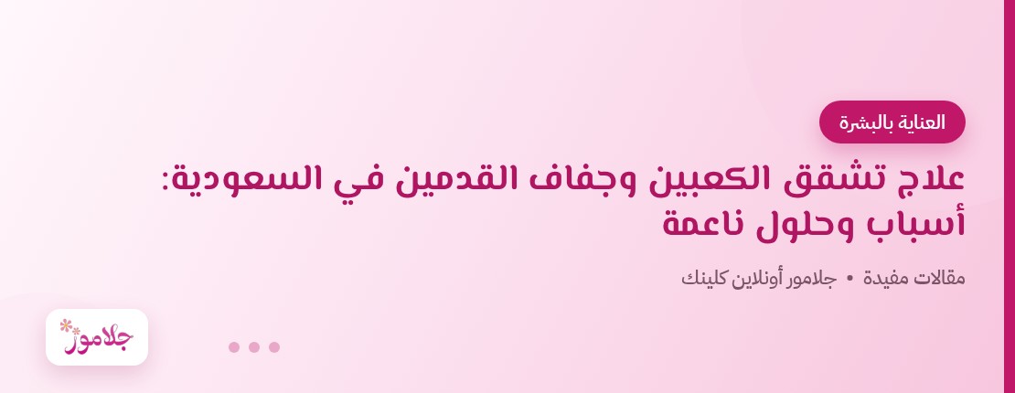 علاج تشقق الكعبين وجفاف القدمين في السعودية: أسباب وحلول ناعمة