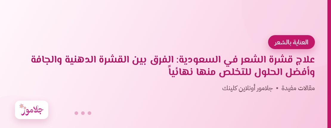 علاج قشرة الشعر في السعودية: الفرق بين القشرة الدهنية والجافة وأفضل الحلول للتخلص منها نهائياً